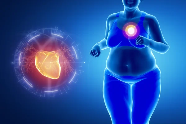 Fat running woman with heart problem — Stock Photo, Image
