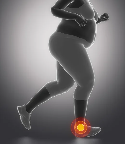 Бег женщина с ожирением лодыжки проблемы — стоковое фото