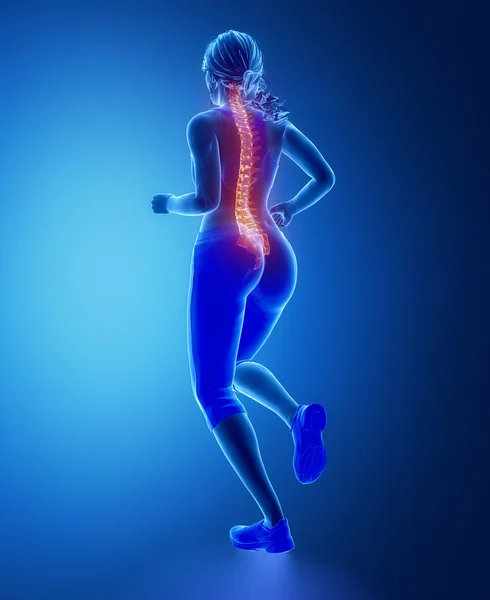 Woman with spine problem concept — Φωτογραφία Αρχείου