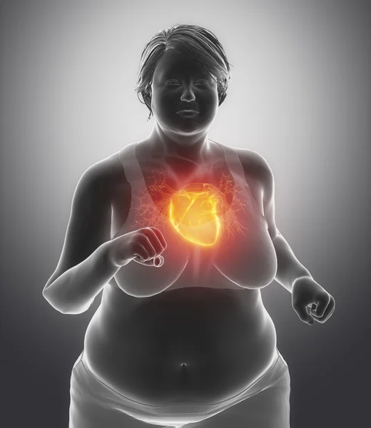 Fat woman  with heart issue — Stock Photo, Image