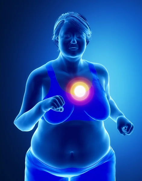 Fat woman with heart problem — Stock Photo, Image