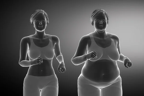 Von Fettleibigkeit zu gesundem Lebensstil — Stockfoto