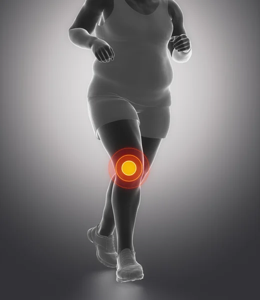 Running man and knee joint ache — Stockfoto