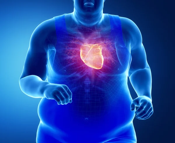 Fat man running with heart attack — Stock Photo, Image