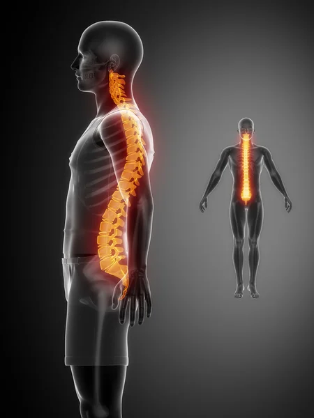 SPINE bones scan — Stock Photo, Image