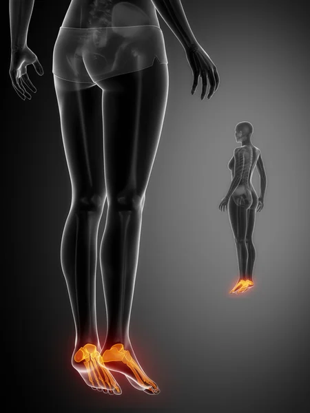 ANKLE black bones scan — Stock Photo, Image