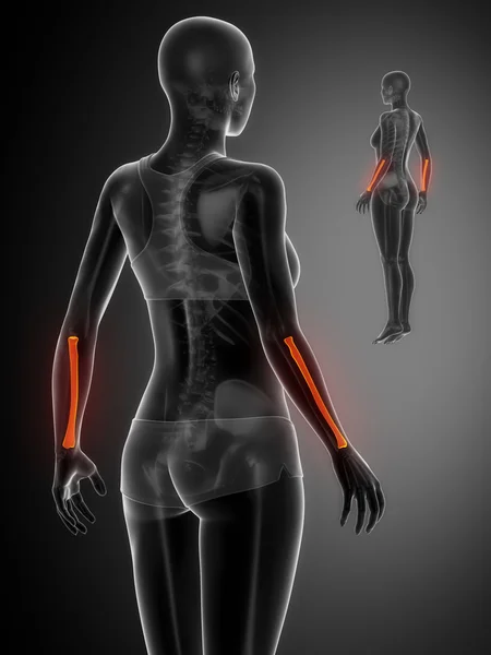 RADIUS x--ray bones scan — Stockfoto