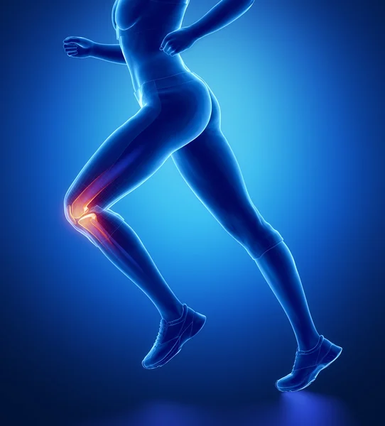 Running woman with knee anatomy — Stock Photo, Image