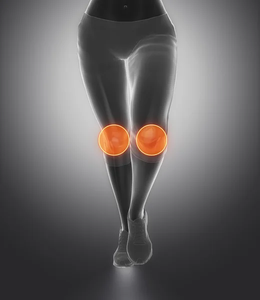 Knee and meniscus in sports injuries — Stock Photo, Image