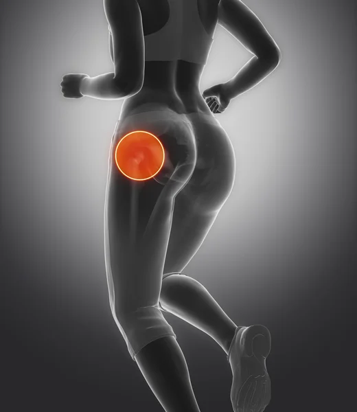 Correndo mulher com lesões esportivas — Fotografia de Stock