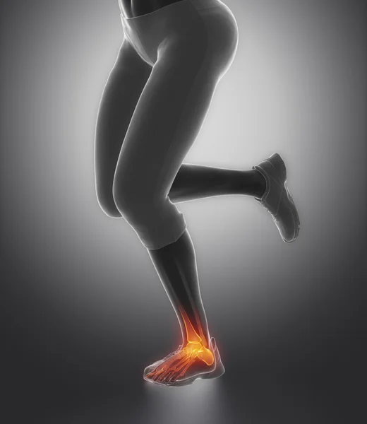 Running woman with Ankle pain — Stock Photo, Image