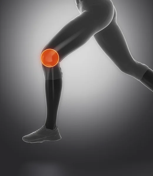 Běžící žena Zaostřeno na koleno — Stock fotografie