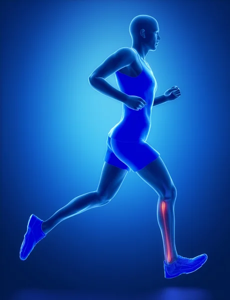 Running man with leg scan — Stock Photo, Image