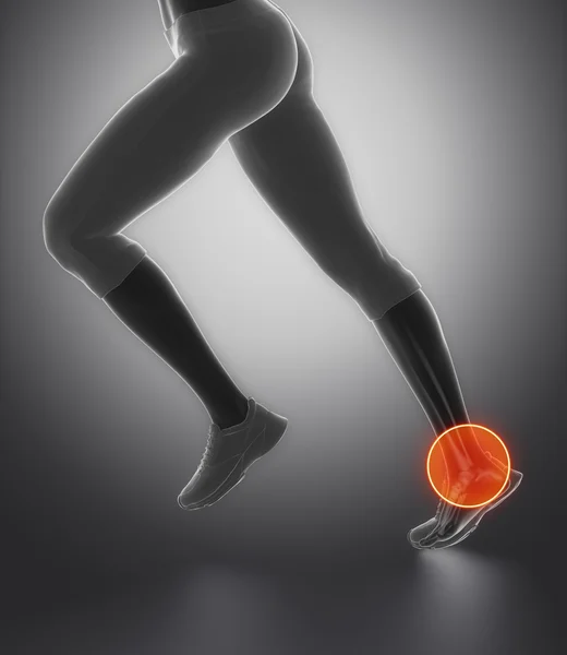 Yaralı ayak bileği ve Aşil tendonu — Stok fotoğraf
