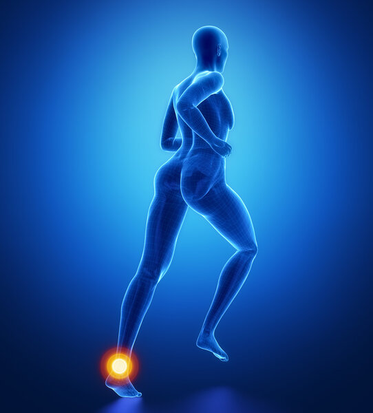 Бегущая женщина с травмой лодыжки
