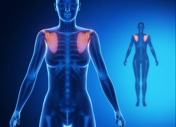 Kvinnliga kroppen med skulderbladet skelettscintigrafi — Stockfoto