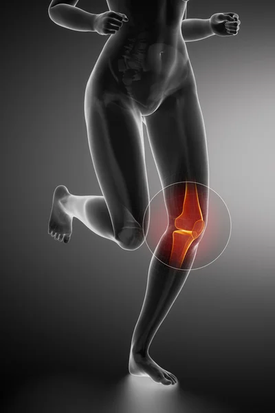 Donna in corsa con anatomia del ginocchio — Foto Stock