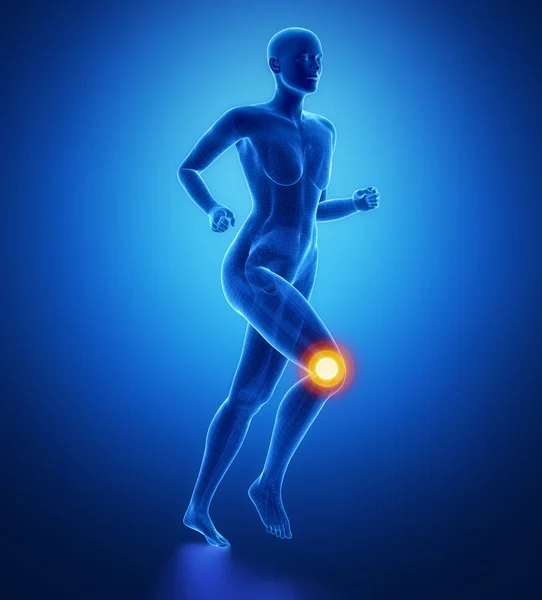 Running woman Injured knee — Stock Photo, Image