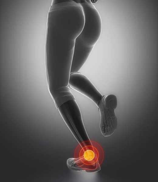 Correndo mulher ferido tornozelo — Fotografia de Stock