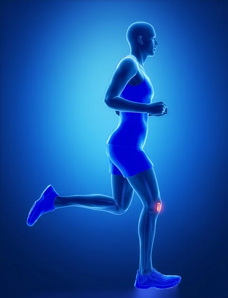 Running man with  leg scan — Stock Photo, Image