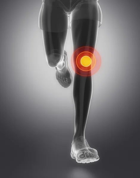 Running man with  Knee anatomy — Stock Photo, Image