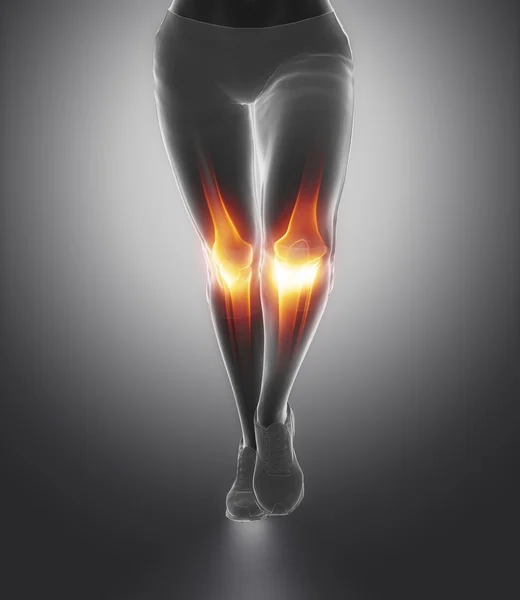 Knee and meniscus in sports injuries — Stock Photo, Image