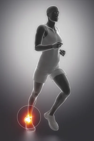 Hombre corriendo Centrado en la articulación del tobillo — Foto de Stock