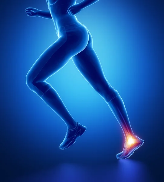 Mujer corriendo tobillo lesionado — Foto de Stock