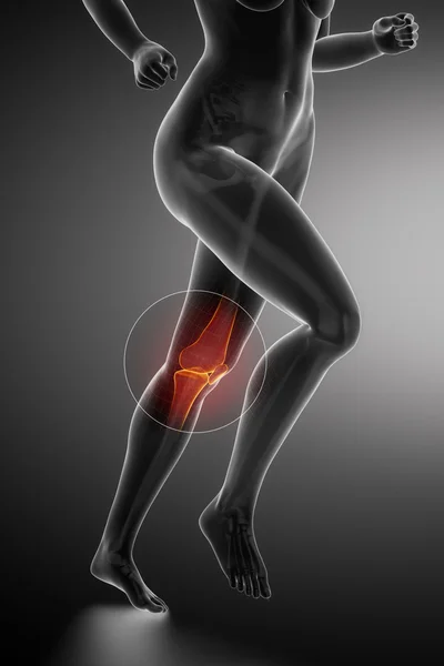 Lopende vrouw met knie anatomie — Stockfoto