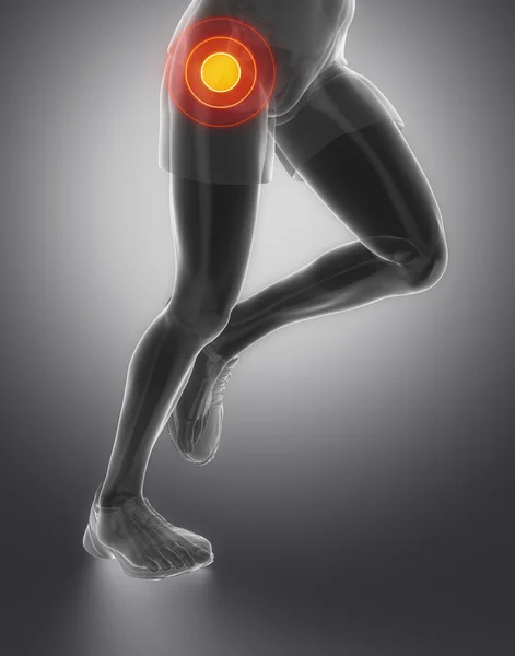 Hombre corriendo con centrado en la articulación de la cadera — Foto de Stock