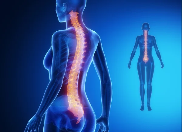 SPINE blue x--ray bone scan — Stock Photo, Image