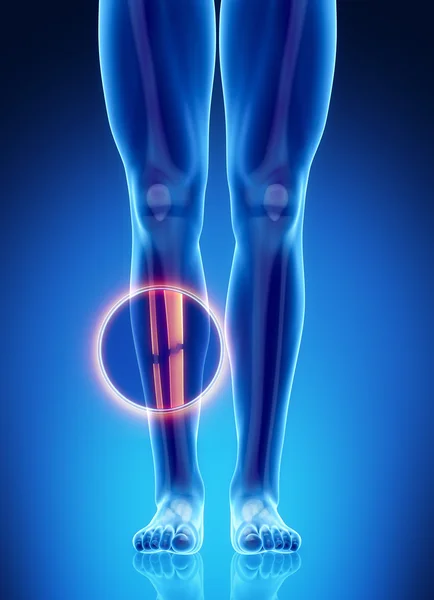 Male bone anatomy — Stock Image Male bone anatomy Stock Picture