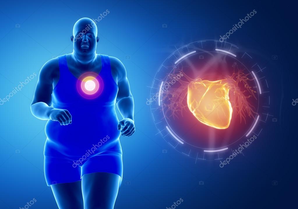 Jogging man with heart attack — Stock Photo © CLIPAREA 74135981