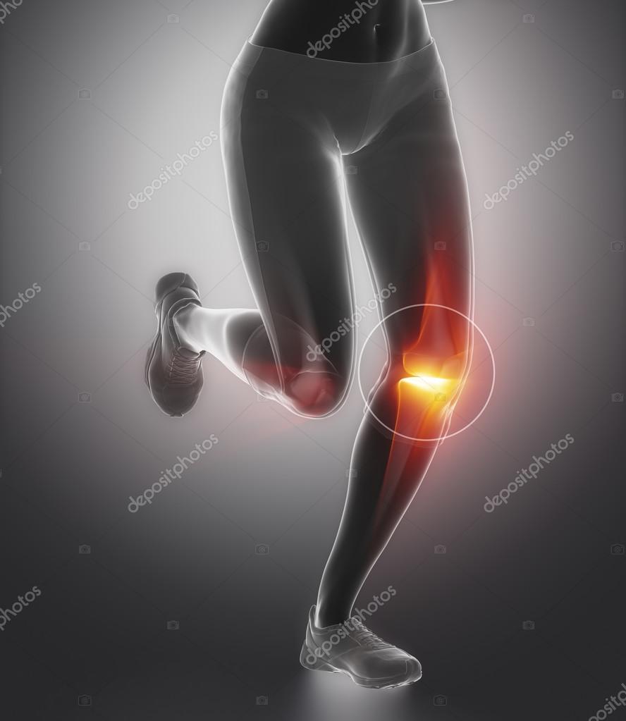 Knee and meniscus in sports injuries — Stock Photo © CLIPAREA 74137953