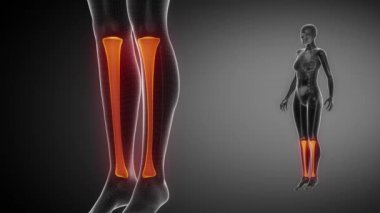 Tibia kemik iskelet x-ray tarama