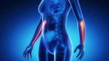 Dirsek kemiği kemik iskelet x-ray tarama