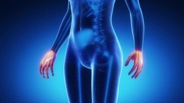 Bilek kemiği iskelet x-ray tarama