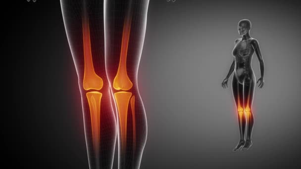 Escáner de rayos X de esqueleto óseo de rodilla en negro — Vídeos de Stock