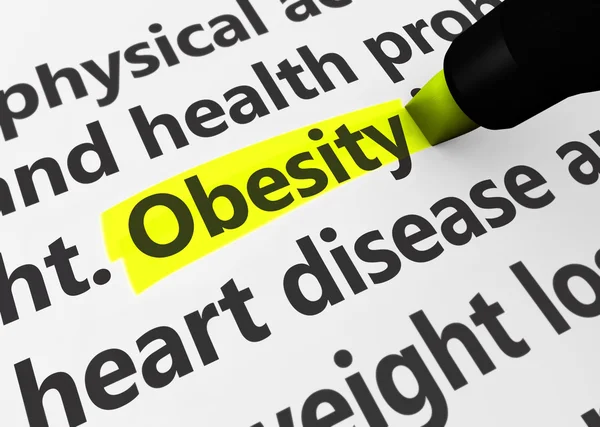 Obesity — Stock Photo, Image