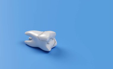 Kırık diş, mavi arka planda izole edilmiş. 3d resimleme