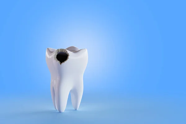 Tooth Hole Blue Background Render Illustration — Stock Photo, Image