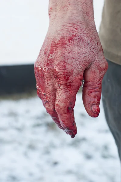 Hand with blood — Stock Photo, Image