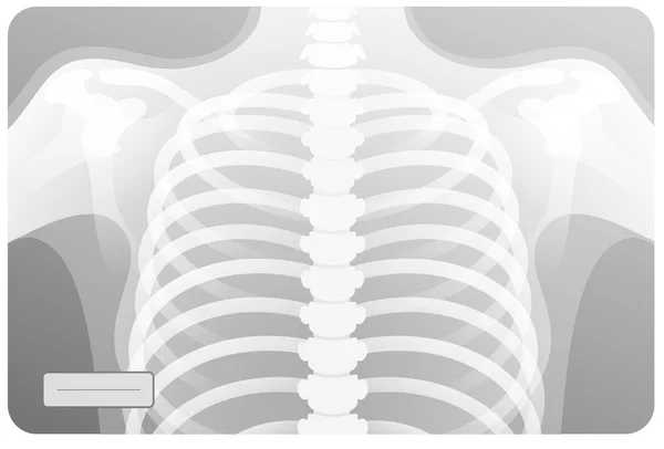 Na RTG klatki piersiowej człowieka klatki piersiowej — Wektor stockowy