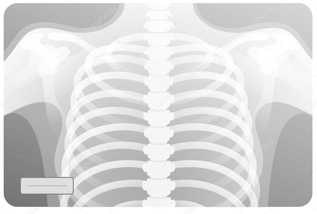 An x-ray of human thorax, chest. Vector illustration, medical icon. The human skeleton, anatomy part