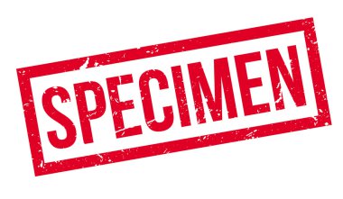 Numune pencere boyutu