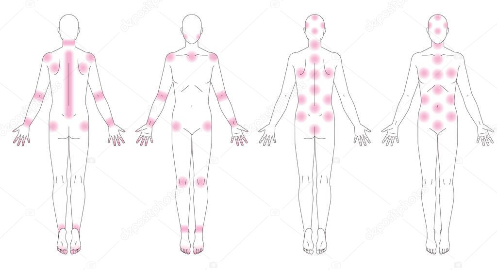 Human body. Places where pain occurs. Schematic diagram without gender.