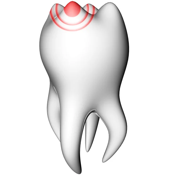 Conceito de dor de dente — Fotografia de Stock