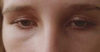 Bunalımlı Genç Kadının Kahverengi Gözleri