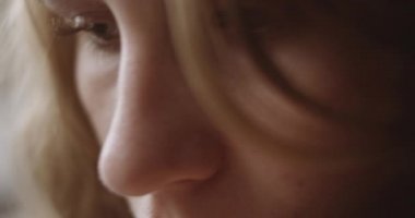 Depresyondaki Genç Kadın Koluna Yaslanıyor