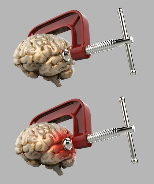 Cefalea cerebral en una pinza aislada — Foto de Stock